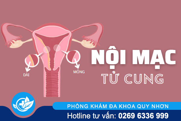 Tìm hiểu về nội mạc tử cung và vấn đề liên quan