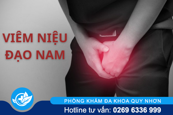Các thông tin cần lưu ý về viêm niệu đạo nam