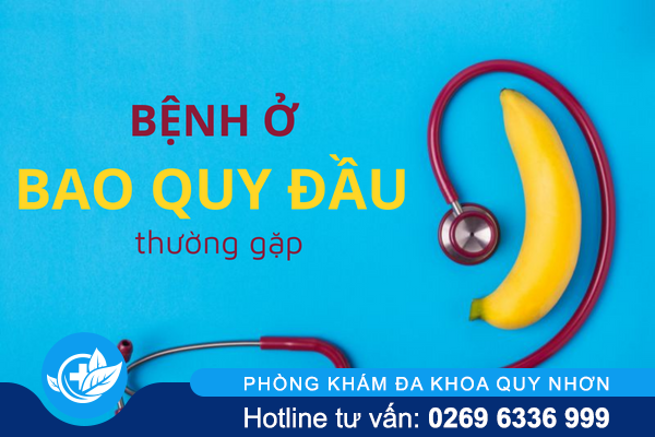 Điểm danh các bệnh ở bao quy đầu thường gặp