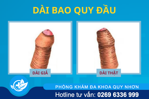 diem-danh-cac-benh-o-bao-quy-dau-thuong-gap-1