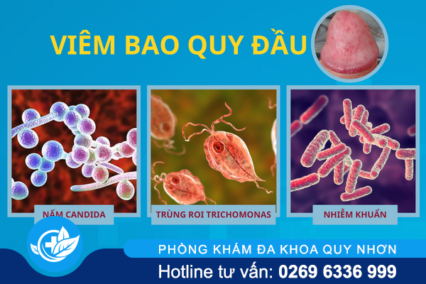 diem-danh-cac-benh-o-bao-quy-dau-thuong-gap-3