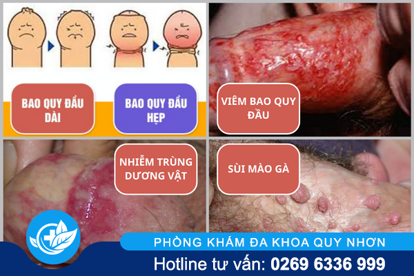 ngua-bao-quy-dau-khong-chi-kho-chiu-con-tiem-an-nguy-hiem-1