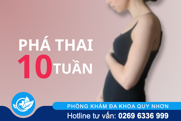 Phương pháp phá thai 10 tuần an toàn