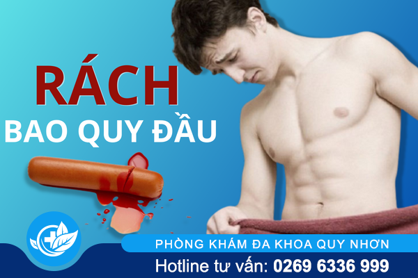 Rách bao quy đầu – Tai nạn gây nhiều ảnh hưởng xấu