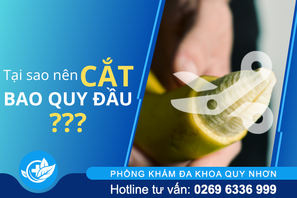 Tại sao nên cắt bao quy đầu?