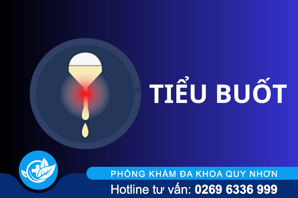 Tiểu buốt – Sự bất thường cảnh báo bệnh lý
