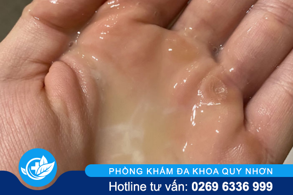 tinh-trung-loang-khien-nam-gioi-kho-lam-cha-1