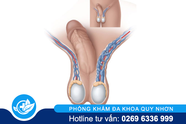 tinh-trung-loang-khien-nam-gioi-kho-lam-cha-2