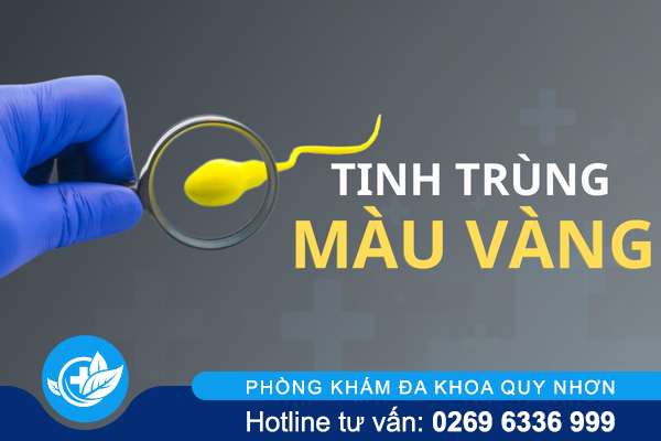 Tinh trùng màu vàng không nên lơ là