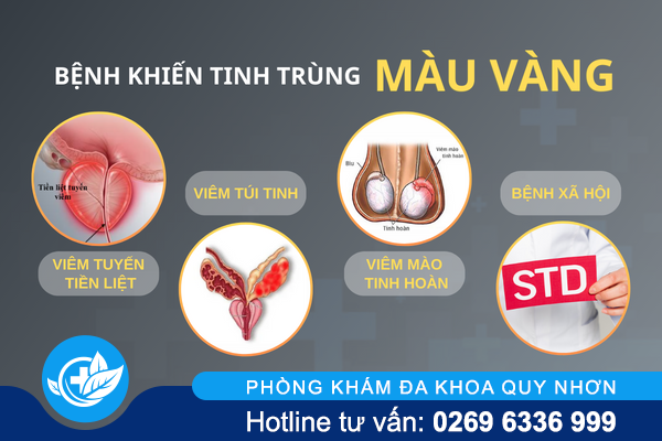 tinh-trung-mau-vang-khong-nen-lo-la-1