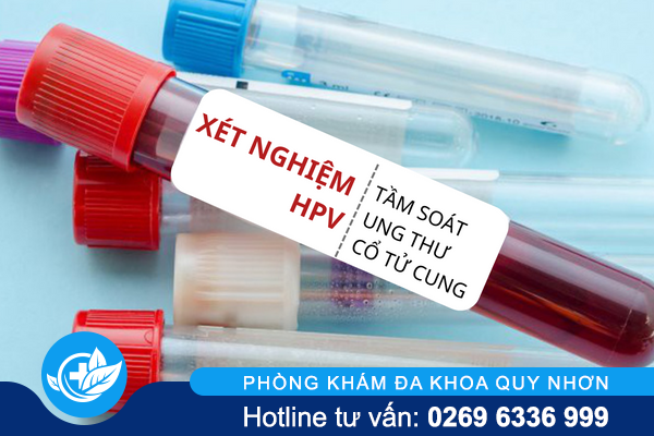 Xét nghiệm HPV tầm soát ung thư cổ tử cung