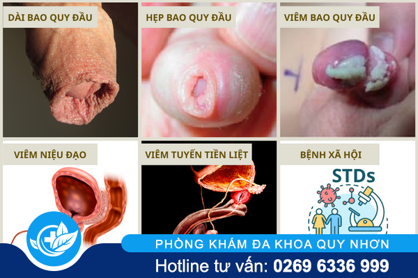 can-than-voi-cac-con-dau-bao-quy-dau-1