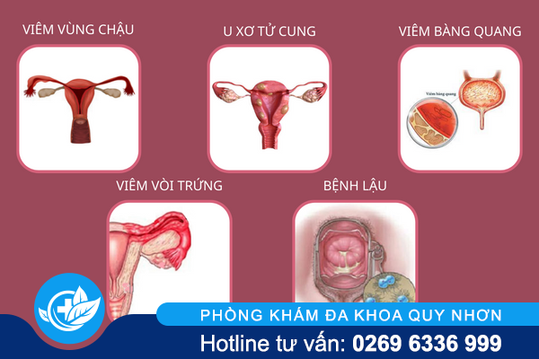 canh-bao-nguy-hiem-tu-con-dau-bung-duoi-o-nu-2