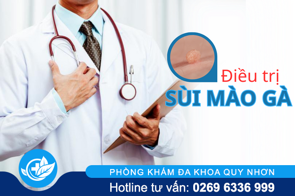 Đâu là phương án điều trị sùi mào gà chính xác?