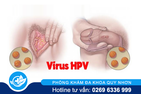 dau-la-phuong-an-dieu-tri-sui-mao-ga-chinh-xac-1