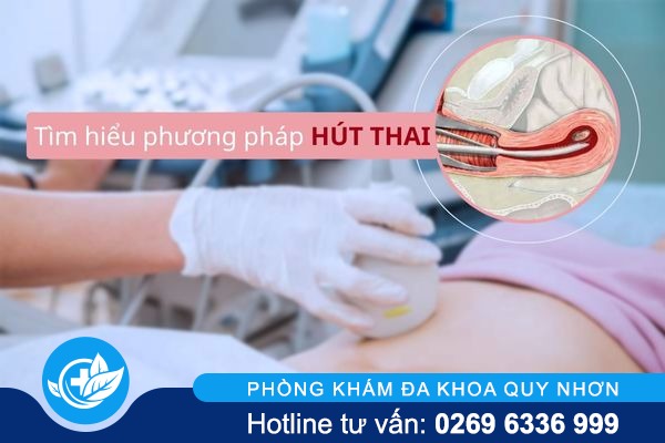 Hút thai an toàn là như thế nào? Cần lưu ý gì khi thực hiện?