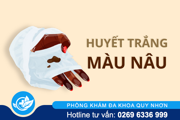 Huyết trắng màu nâu – Dấu hiệu cảnh báo nguy hiểm