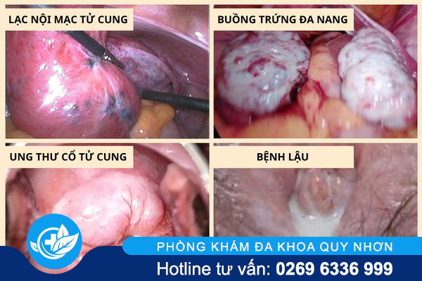 huyet-trang-mau-nau-dau-hieu-canh-bao-nguy-hiem-2