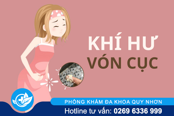 Khí hư vón cục không hiếm gặp nhưng rất nguy hiểm