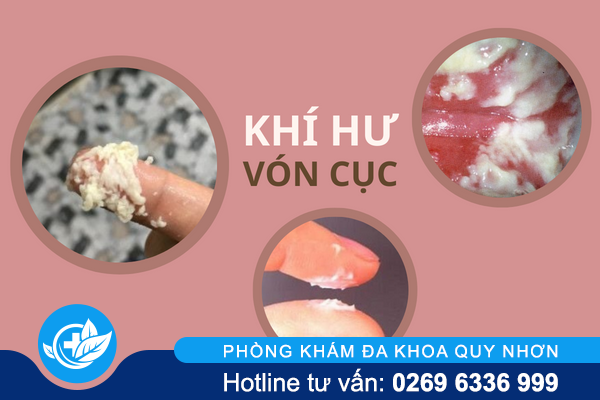 khi-hu-von-cuc-khong-hiem-gap-nhung-rat-nguy-hiem-1