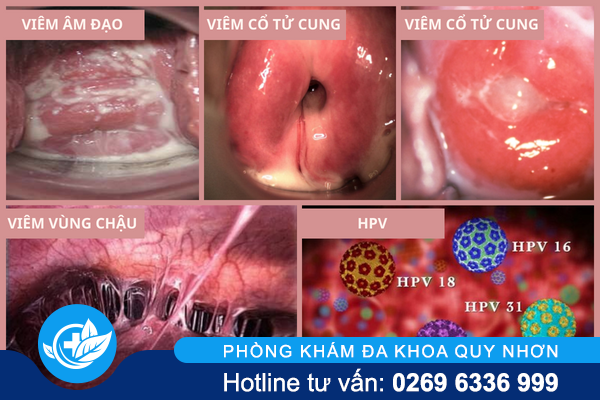 khi-hu-von-cuc-khong-hiem-gap-nhung-rat-nguy-hiem-2