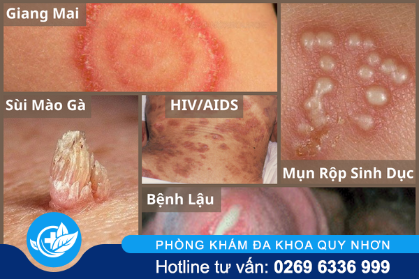 mot-lan-may-mua-ca-doi-an-han-2