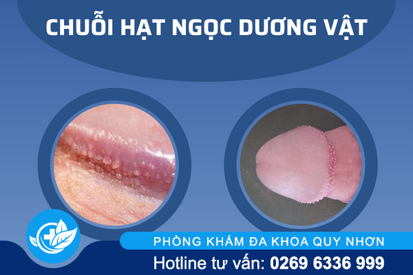 noi-mun-o-bao-quy-dau-nguyen-nhan-va-cach-giai-quyet-hieu-qua-2