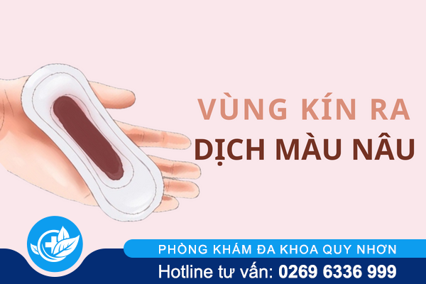 Vùng kín ra dịch màu nâu cảnh báo vấn đề phụ khoa