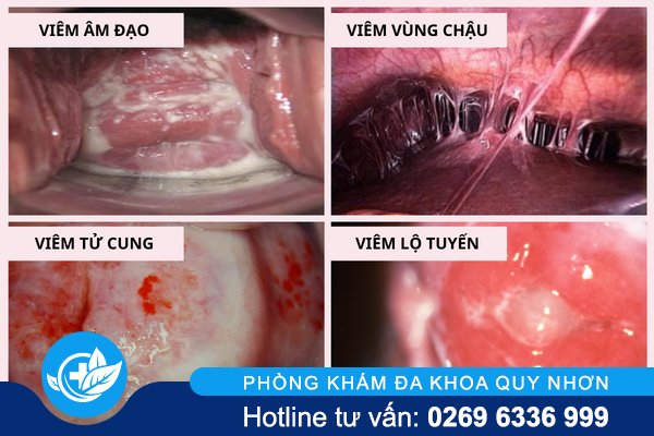 vung-kin-ra-dich-mau-nau-canh-bao-van-de-phu-khoa-2