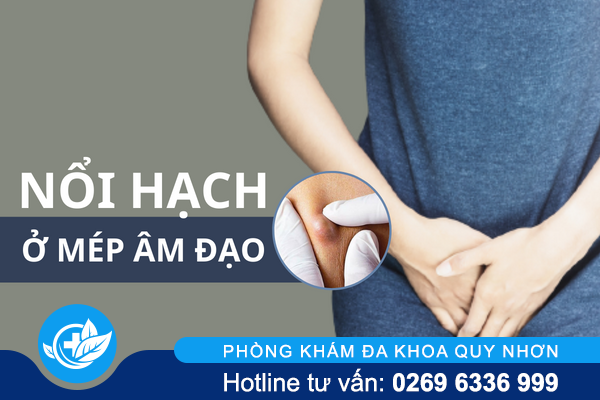 Cảnh báo tình trạng nổi hạch ở mép âm đạo
