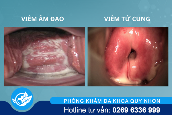 het-kinh-lai-ra-mau-dang-gap-van-de-gi-1