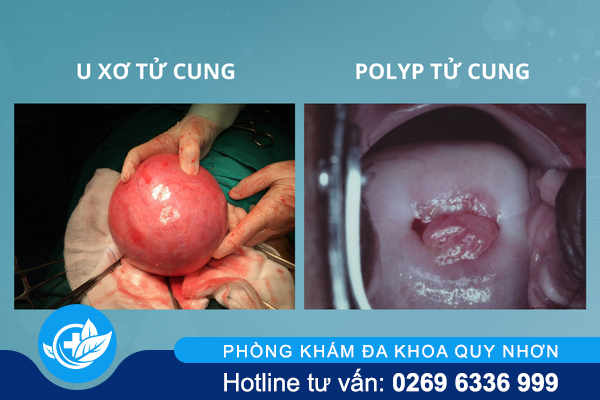 het-kinh-lai-ra-mau-dang-gap-van-de-gi-2