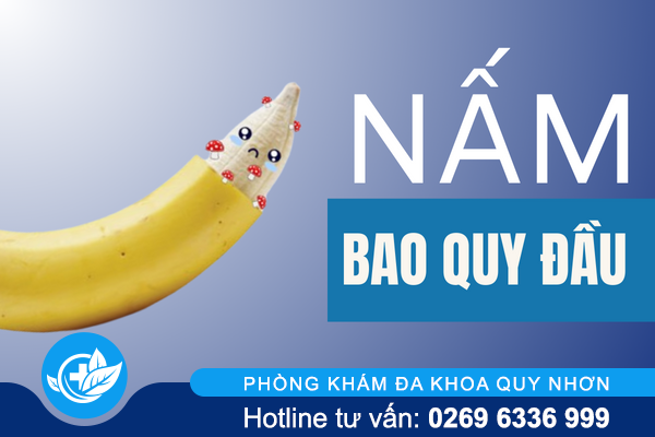 “Báo động” tình trạng nấm bao quy đầu