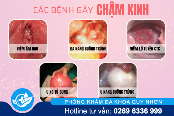 cham-kinh-dau-hieu-benh-gi-hay-co-thai-1