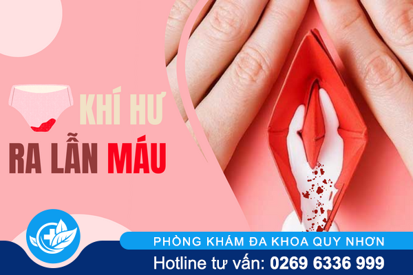 Khí hư ra lẫn máu cảnh báo vấn đề gì?