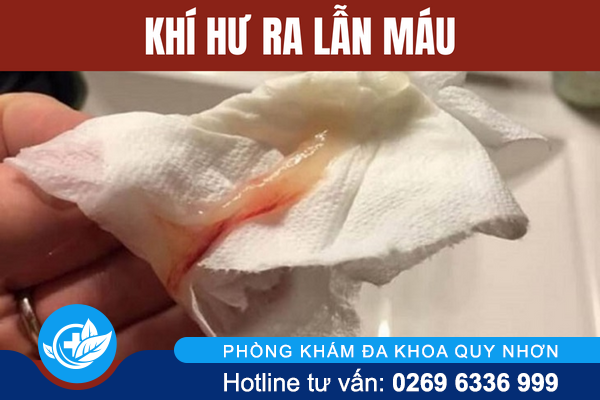 khi-hu-ra-lan-mau-canh-bao-van-de-gi-1