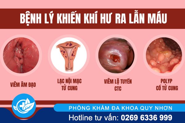 khi-hu-ra-lan-mau-canh-bao-van-de-gi-2