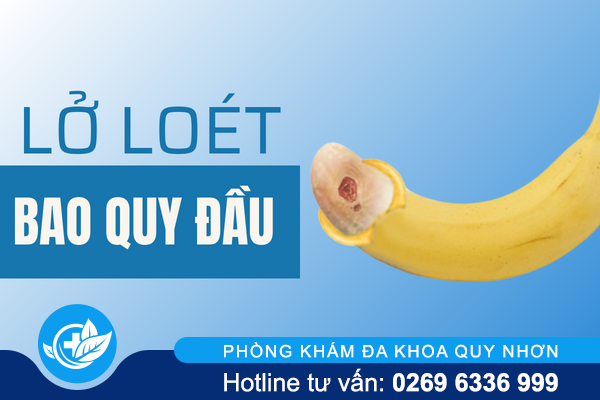 Lở loét bao quy đầu cảnh báo nguy hiểm