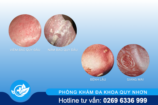 lo-loet-bao-quy-dau-canh-bao-nguy-hiem-1