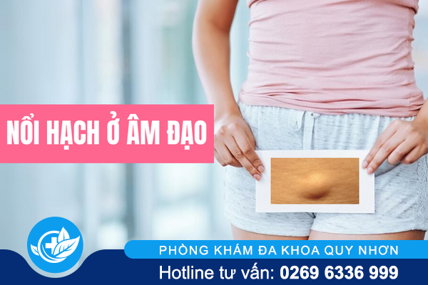 Lý do bị nổi hạch ở âm đạo và cách xử lý hiệu quả.