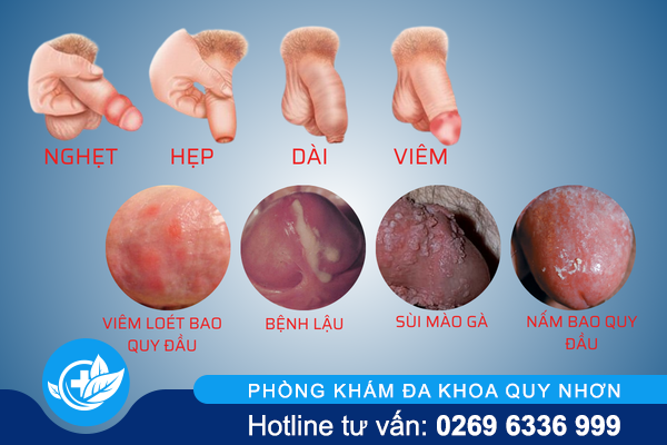 ngua-bao-quy-dau-do-dau-ma-ra-1