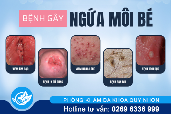 ngua-moi-be-la-dang-bi-gi-1