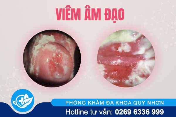 ngua-vung-kin-o-nu-la-dang-bi-gi-1