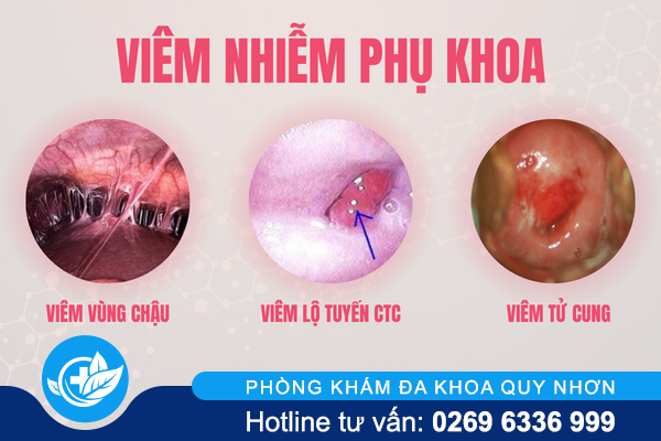 ngua-vung-kin-o-nu-la-dang-bi-gi-2