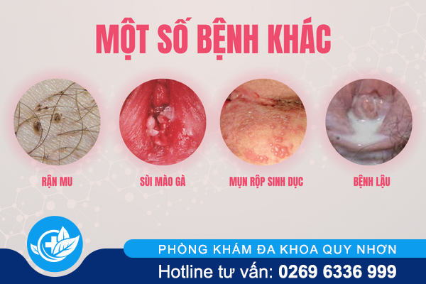 ngua-vung-kin-o-nu-la-dang-bi-gi-3