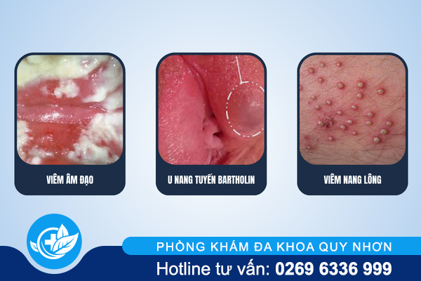 noi-man-do-o-vung-kin-nu-canh-bao-dieu-gi-1