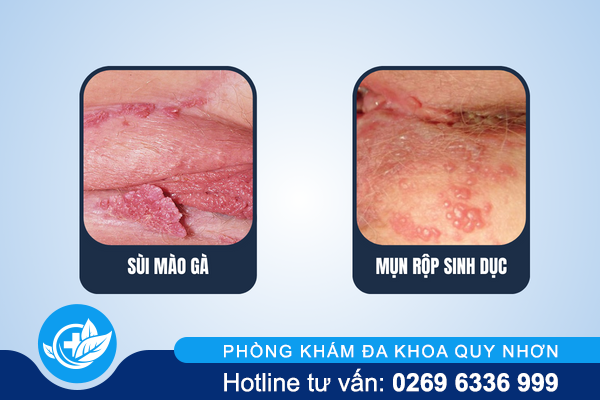 noi-man-do-o-vung-kin-nu-canh-bao-dieu-gi-2