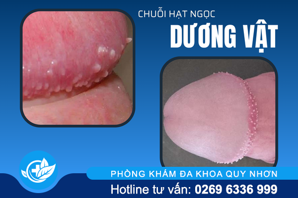 noi-mun-bao-quy-dau-canh-bao-dieu-gi-3