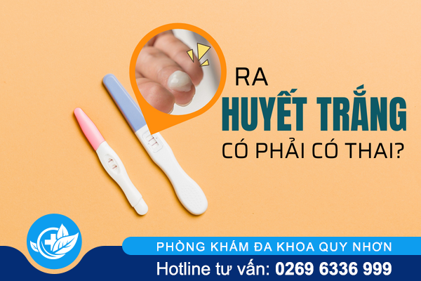 Ra huyết trắng có phải có thai?
