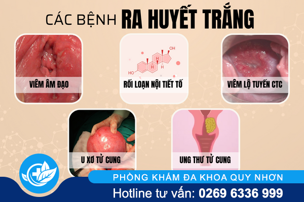 ra-huyet-trang-co-phai-co-thai-2